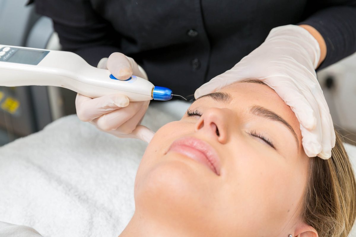 Premier Microneedling Services in San Diego | Prophecy Med Spa