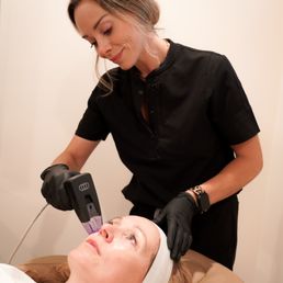 Top Microneedling Services in San Diego | Prophecy Med Spa