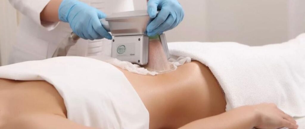 Cryolipolysis in San Diego - Non-Surgical Fat Reduction | Prophecy Med Spa