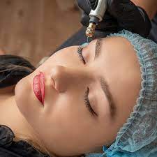 Premier Microneedling Services in San Diego | Prophecy Med Spa