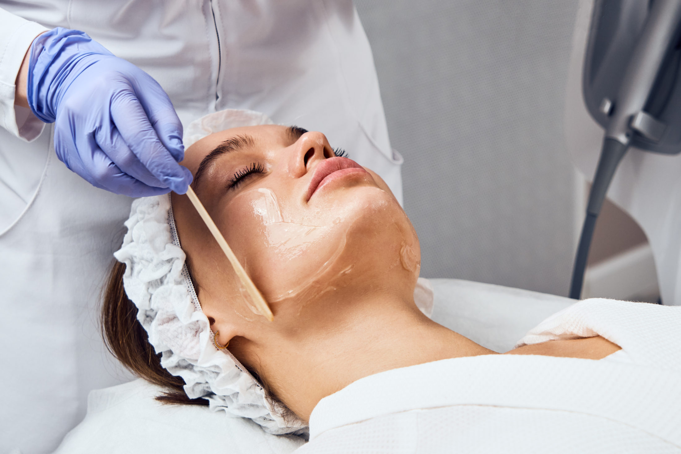 Experience Effective Chemical Peel in San Diego | Prophecy Med Spa