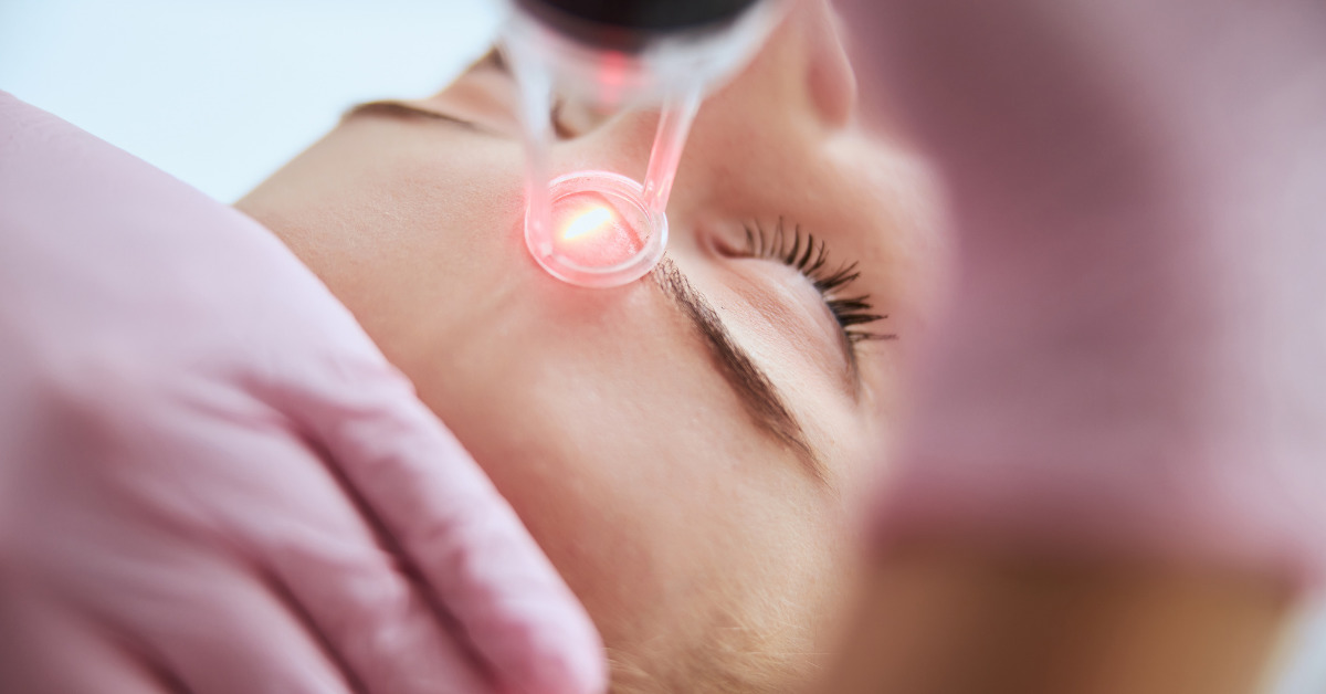 Revitalize your skin with Prophecy Med Spa's laser skin resurfacing in San Diego. Reduce wrinkles and scars for a youthful look. Book your session today!