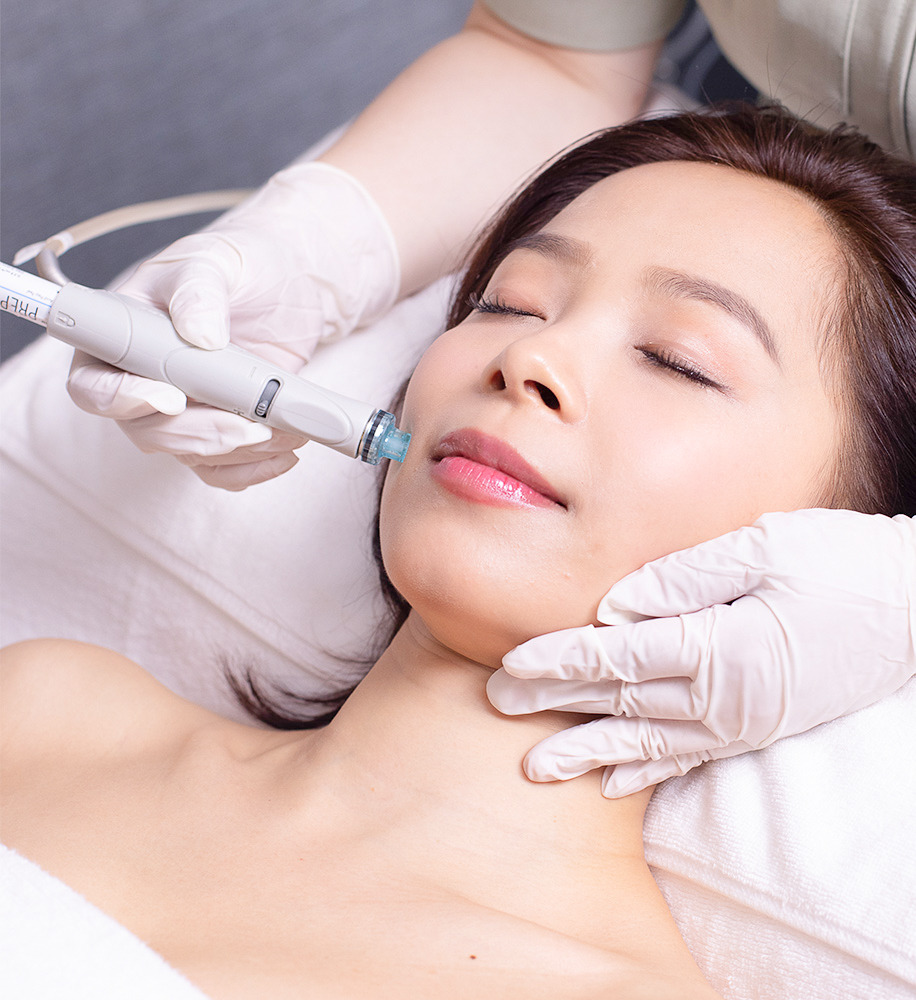 Top Microneedling Services in San Diego | Prophecy Med Spa